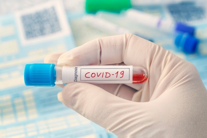 CIFRE ÎNGRIJORĂTOARE. Numărul cazurilor noi de CORONAVIRUS raportate astăzi se apropie de 1.500